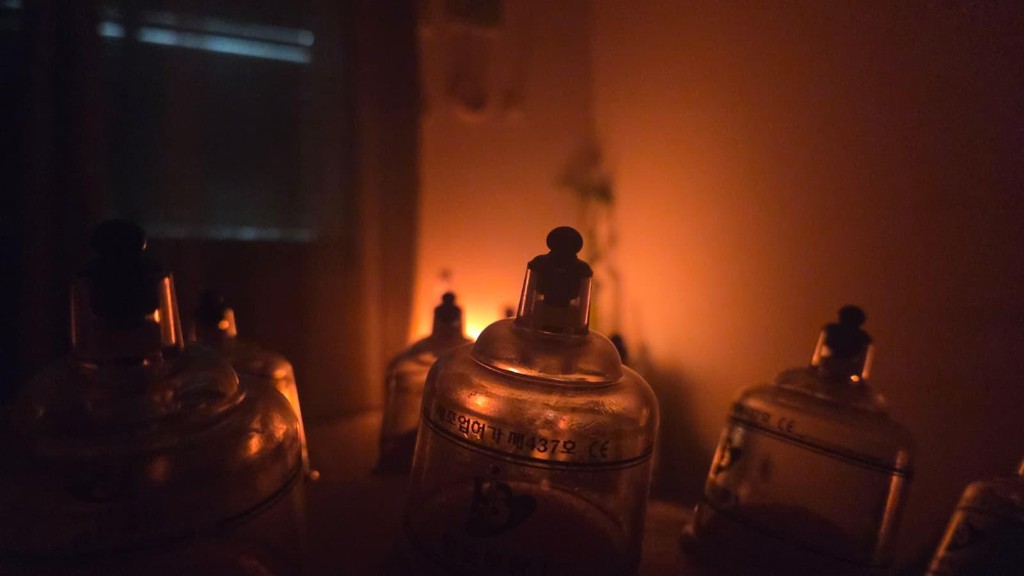 כוסות רוח מקצועיות לטיפול בשחרור שרירים ושיפור זרימת הדם – מגע הזהב אלעד